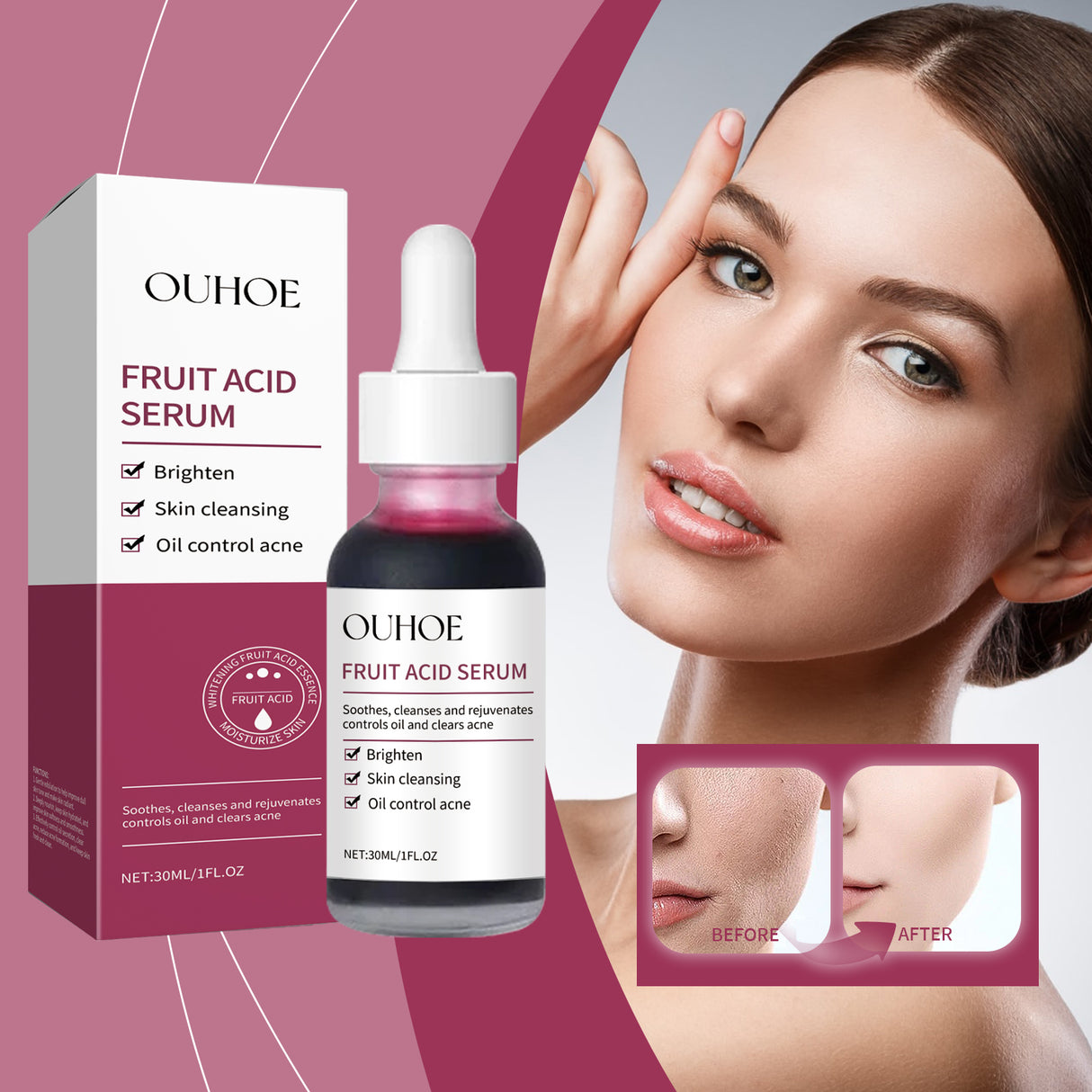 Fruit Acid Purifying Essence, Gentle Exfoliating, Moisturizing And Moisturizing Daily Skin Care Essence - V.I.P Digital Presence