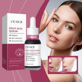 Fruit Acid Purifying Essence, Gentle Exfoliating, Moisturizing And Moisturizing Daily Skin Care Essence - V.I.P Digital Presence