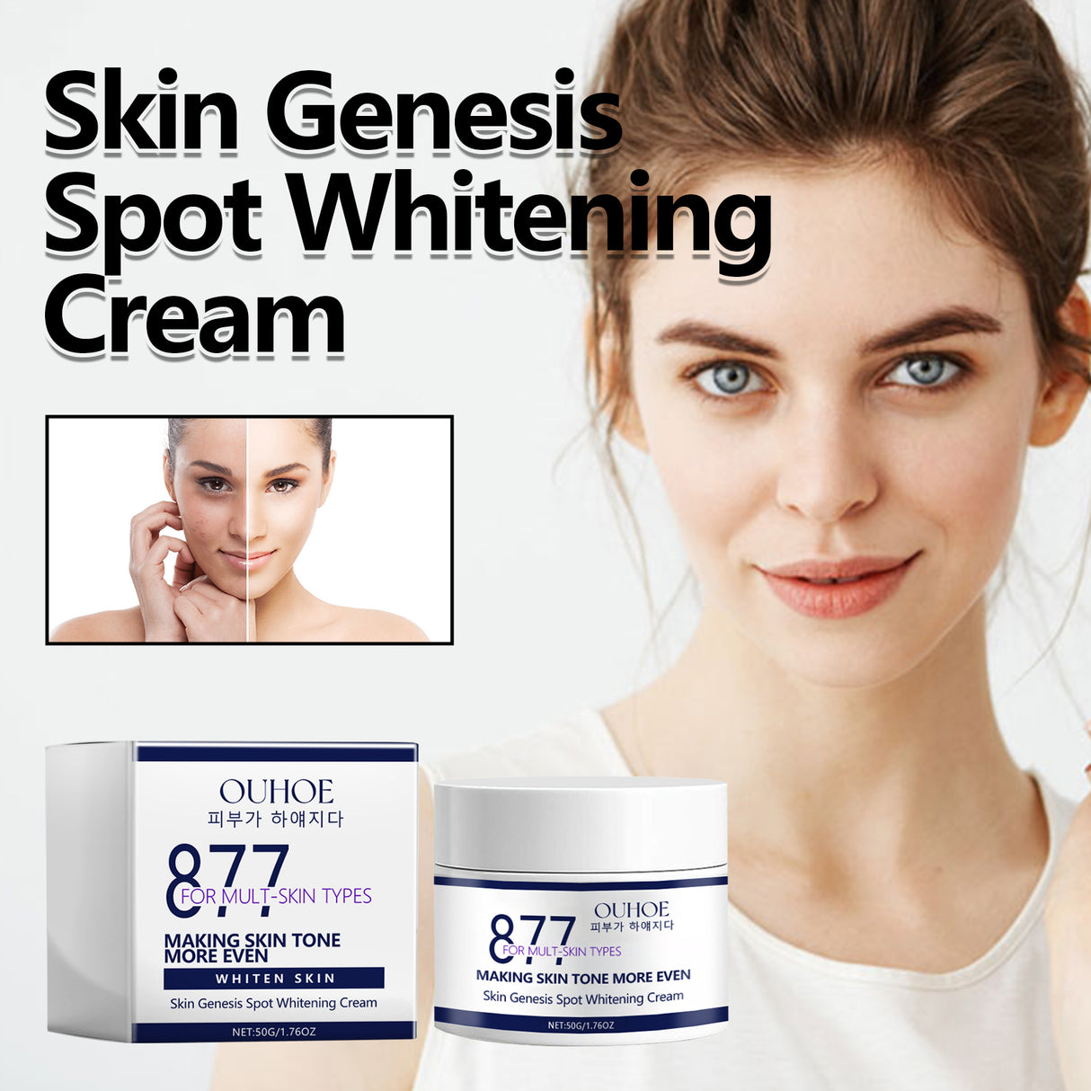 Skin Genesis Spot Whitening Cream, Moisturizing and rejuvenating Skin Whitening body Skin care cream - V.I.P Digital Presence