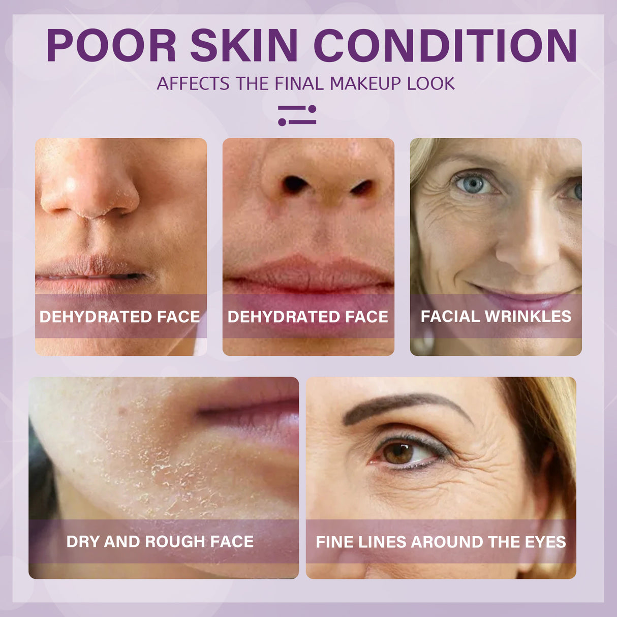 Moisturizer Improves Dry Skin Cream Tightens And Lightens Wrinkles Hydrating Moisturizing Moisture Easy To Absorb - V.I.P Digital Presence