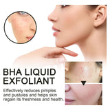 BHA Liquid Exfoliant, Lightening Acne Seal Pore-Tightening And Moisturizing Skin Essence - V.I.P Digital Presence