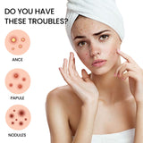 Acne Patch, Repair Facial Acne Invisible Concealer Hydrocolloid Patch - V.I.P Digital Presence