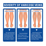 Leg Care Cream Relieves Leg Discomfort Pamper And Moisturize Skin Daily Massage Treatment - V.I.P Digital Presence