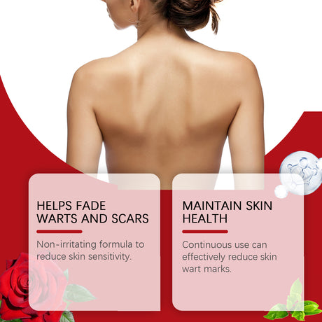 Rosehip Seed And Wart Essence Oil, Moisturizes And Restores Smooth Skin - V.I.P Digital Presence