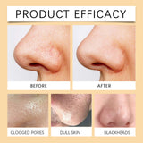 Enzymes Exfoliating Brightening Gel, Gentle Exfoliating Cleansing Gel Deeply Purifies Pores, Removes Blackheads And Brightens Skin - V.I.P Digital Presence