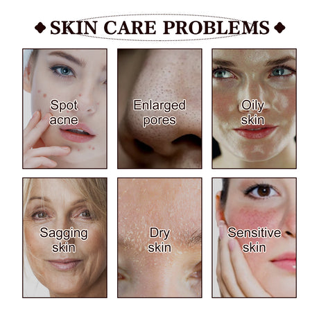 Black Tea Extract Cleansing Mask, Clean And Delicate Pore Brightening Skin Rejuvenating Daub Type Facial Mask - V.I.P Digital Presence