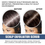 Scalp Exfoliating Scrub Moisturizes Dry Hair And Scalp Cleansing Treatment Refreshing Scrub - V.I.P Digital Presence