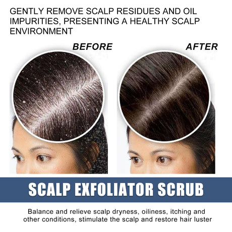 Scalp Exfoliating Scrub Moisturizes Dry Hair And Scalp Cleansing Treatment Refreshing Scrub - V.I.P Digital Presence