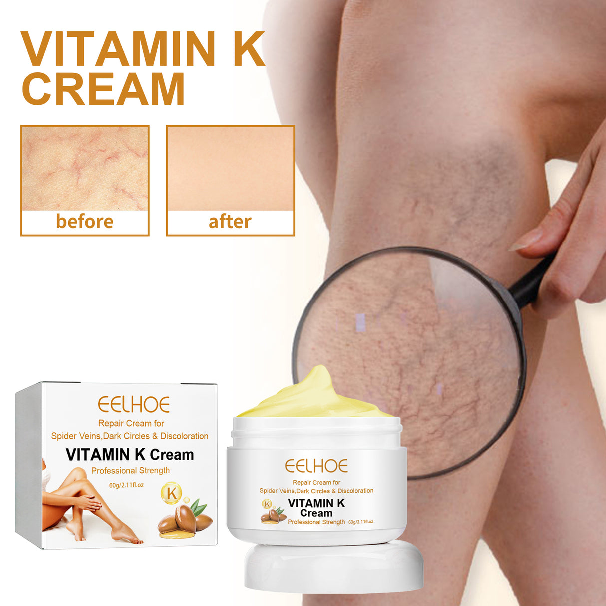 Vitamin K Cream Skin Care For Sore And Swollen Legs Earthworm Leg Vein Massage Cream - V.I.P Digital Presence