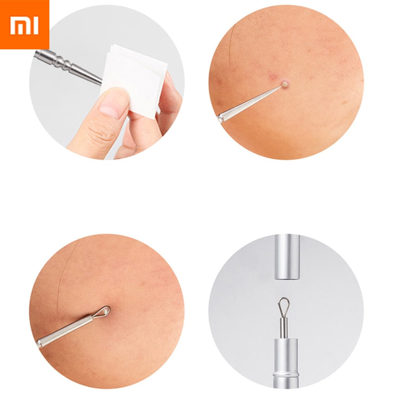 Xiaomi Youpin Jordan Judy - Extractor de puntos negros y acné con agujas de acero inoxidable 