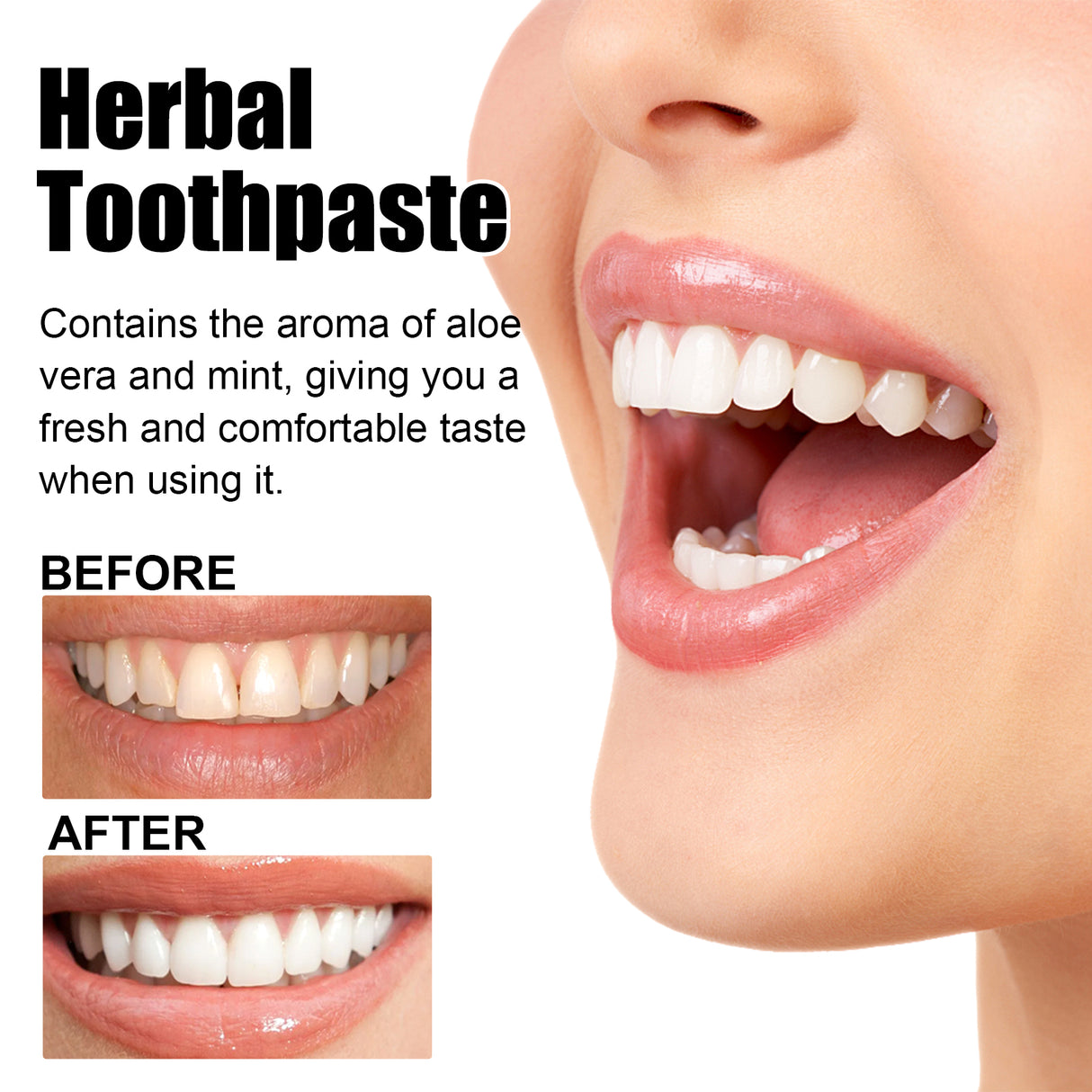 Aloe Whitening Toothpaste Cleans Mouth, Removes Odor, Freshens Breath, Removes Stains, Brighens Teeth And Beautifies Teeth - V.I.P Digital Presence