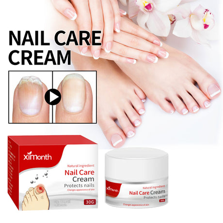 Nail Care Cream, Light Armor Repair Bad Ingrown Nail Nails Brothers Nail Thickening A Ditch Nursing - V.I.P Digital Presence