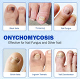 FungaFix Nail Patches