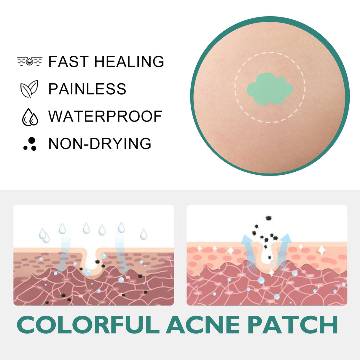 Colorful Acne Patch, Repair Pit Acne Print Smooth Skin Lightening Spot Clear Acne Facial - V.I.P Digital Presence