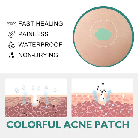 Colorful Acne Patch, Repair Pit Acne Print Smooth Skin Lightening Spot Clear Acne Facial - V.I.P Digital Presence