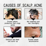 West & Month Anti-Shedding Hair Spray, Improve The Hairline Hair Hair Nutrition Moisture Hair Roots - V.I.P Digital Presence