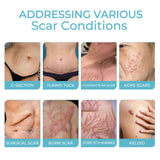 Scarfree Advanced Skin Spray, Body Skin Care Reduces Post-Natal Scars And Smooths Skin - V.I.P Digital Presence
