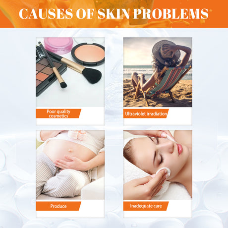 Papaya Whitening Freckle Cream Lightens Dark Spots On The Face, Brightens And Moisturizes The Skin Early And Late - V.I.P Digital Presence