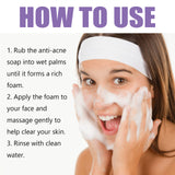 Lavender Oil Control Acne-Cleansing Soap For Cleansing Facial Skin Pores Oil Control Acne-Moisturizing Cleansing Soap - V.I.P Digital Presence