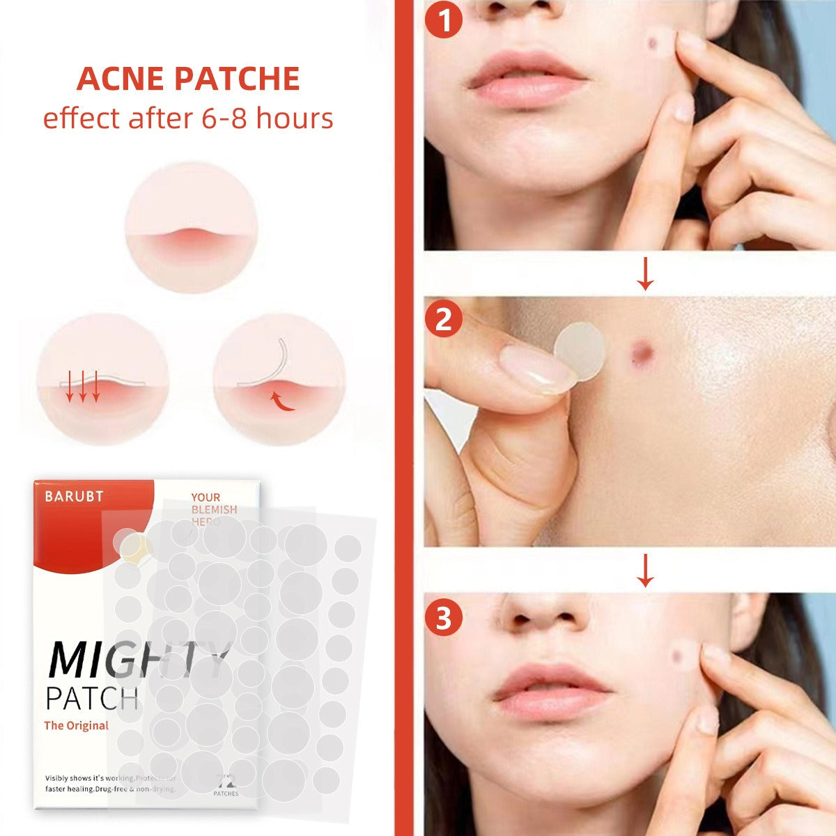 Youbuy invisible acne patch concealer acne patch acne remover without powder stuck acne patch 72 PATCHES - V.I.P Digital Presence