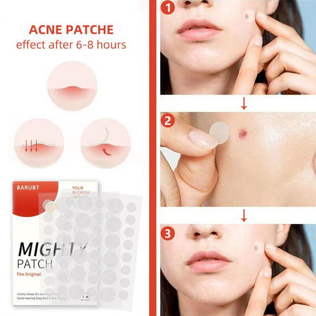 Youbuy invisible acne patch concealer acne patch acne remover without powder stuck acne patch 72 PATCHES - V.I.P Digital Presence