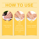 Bee Venom Care Cream, Bee Venom Care Cream To Relieve Inflammation, Pain Swelling Can Improve Joint Health Bunions Adjuvant Therapy - V.I.P Digital Presence