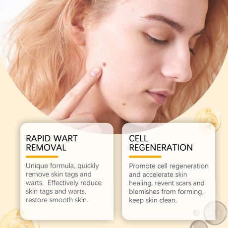 Keyu Care Cream, Gently Clean, Moisturize, Dilute Meat Granules, Repair And Smooth Skin Care Cream - V.I.P Digital Presence