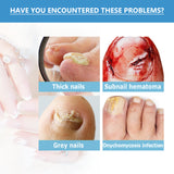 Nighttime Fungal Nail Treatment Patch, Repair Hand And Foot Inlay Rotten Nails Thickening Gray Nail Polish Care Patch - V.I.P Digital Presence