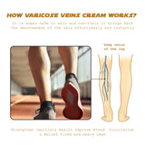 Vein Renewal Smooth Legs Cream, Relief Sore Legs Massage Varicose Earthworm Leg Vein Care Cream - V.I.P Digital Presence