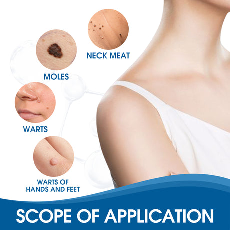 Wart Removers Seal & Heal Patches, Lightening Mole Gram Wart Repair Meat Grain Callus Corns Skin Clean And Smooth Patch - V.I.P Digital Presence