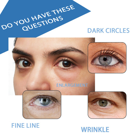 Depuffing Eye Serum, Fade Out Black Rim Of The Eye Moist Tender Firming Eye Week Skin Hydrating Eye Cream - V.I.P Digital Presence