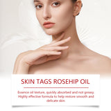 Rosehip Seed And Wart Essence Oil, Moisturizes And Restores Smooth Skin - V.I.P Digital Presence