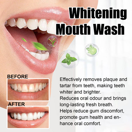 Whitening Mouth Wash, Beauty Shine White Teeth And Fresh Breath Odor Clean Mouth Care Gums - V.I.P Digital Presence