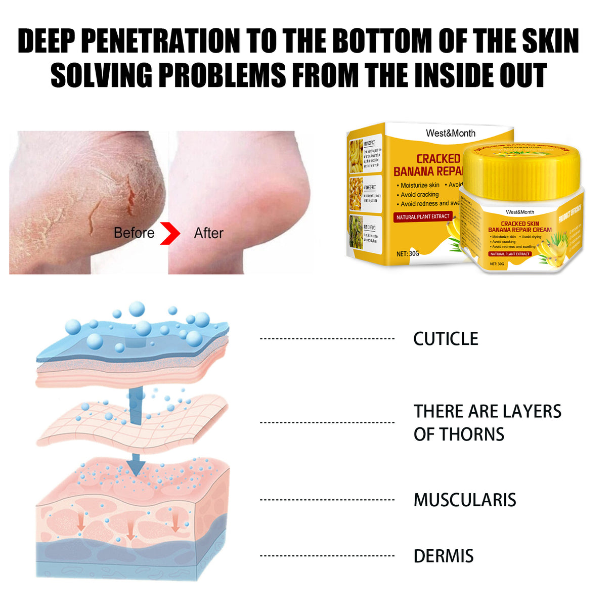 Cracked Skin Banana Repair Cream, Nourishing And Moisturizing Foot Repair Cream To Soften Exfoliation And Remove Dead Skin Calluses - V.I.P Digital Presence