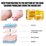 Cracked Skin Banana Repair Cream, Nourishing And Moisturizing Foot Repair Cream To Soften Exfoliation And Remove Dead Skin Calluses - V.I.P Digital Presence