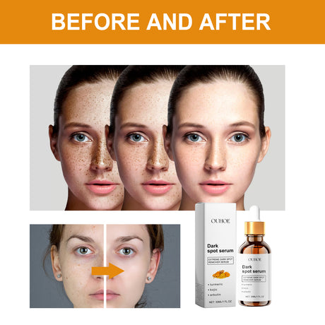 Dark Spot Serum, Hydrating Moist Firming Facial Skin Repair Skin Dark Bright Skin Care Essence - V.I.P Digital Presence