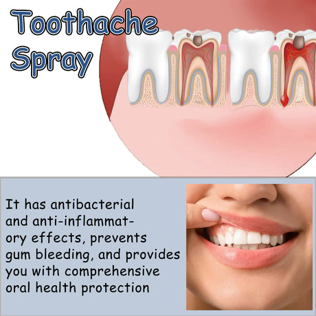Toothache Treatment Spray. Relieve Gum Swelling And Pain On Fire Care For Teeth Toothache Oral Discomfort Care - V.I.P Digital Presence