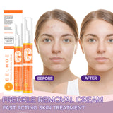 VC Beauty Pen, Moisturizing Facial Skin, Reduce Spots And Melanin Skin Beauty Pen - V.I.P Digital Presence