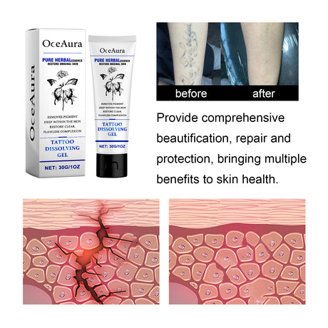 Tattoo Dissolving Gel, Moisturizing Tattoo Skin Repair Skin Tattoo Mark Brightening Care Cream - V.I.P Digital Presence