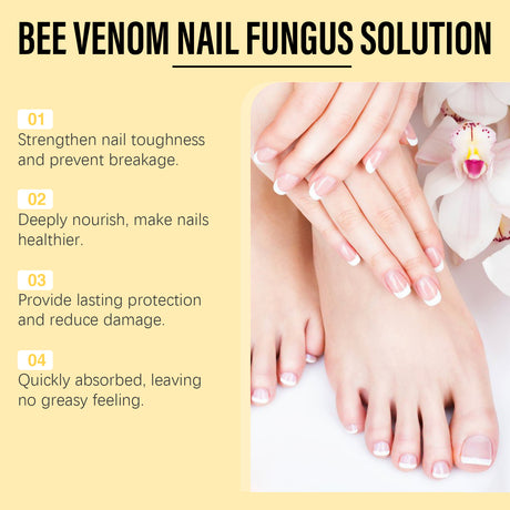 Bee Venom Nail Care Essence Foot Gray Nails Brightening Nails Rotten Nails Soft Nails Nail Care - V.I.P Digital Presence