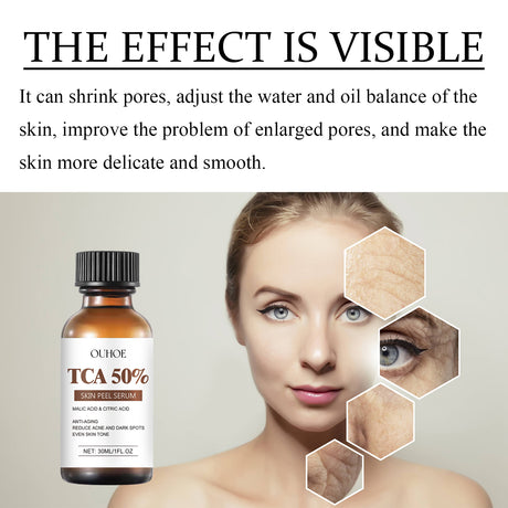 TCA 50 Skin Peel Serum, It Moisturizes Brightens The Firming Skin Fade Wrinkles This Skin Cream - V.I.P Digital Presence