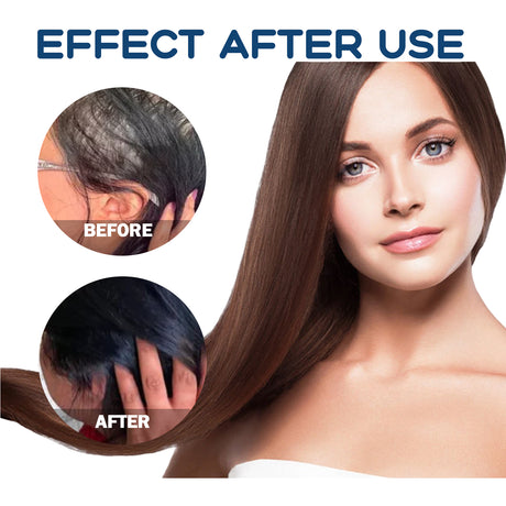 EAST MOON Hair Treatment Spray Moisturizes And Softens Hair, Prevents Loose Hair And Thickens Hair Treatment Spray - V.I.P Digital Presence