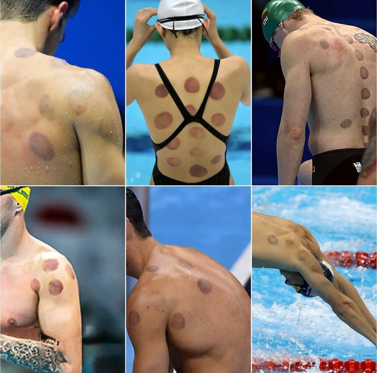 MagnaCupping Therapy Set