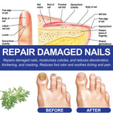 Foot Care Package Repair Soreness And Swelling Relief Foot Soak Foot Clean Nail Calluses Foot Bath Package