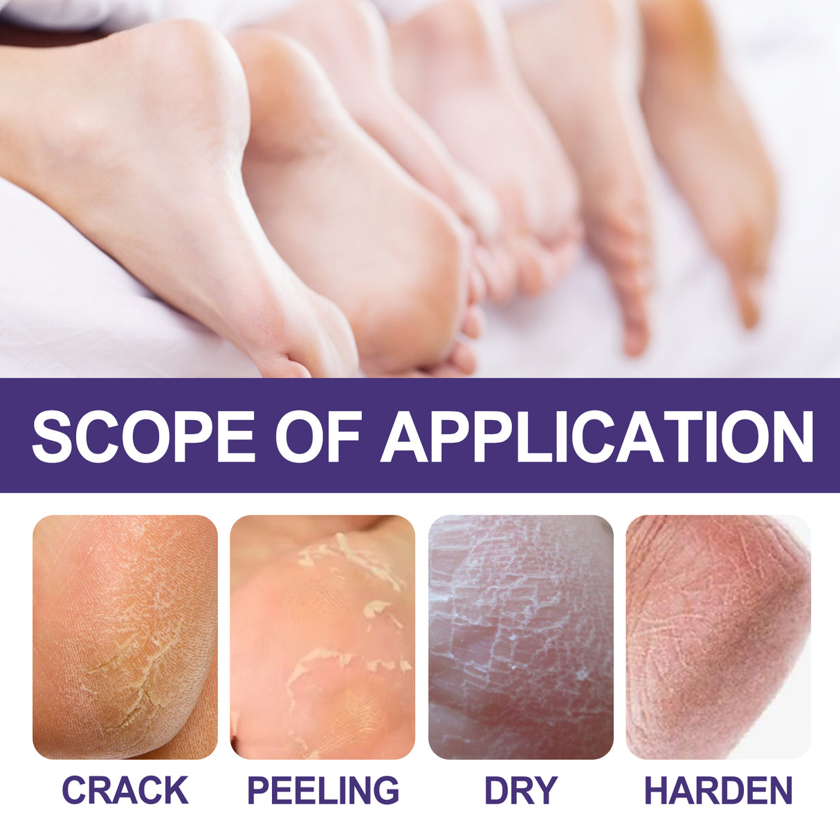 Skin Care Cream, Autumn And Winter Skin Anti-Crack Peeling Exfoliating Moisturizing Soft Moisturizing Body Cream - V.I.P Digital Presence