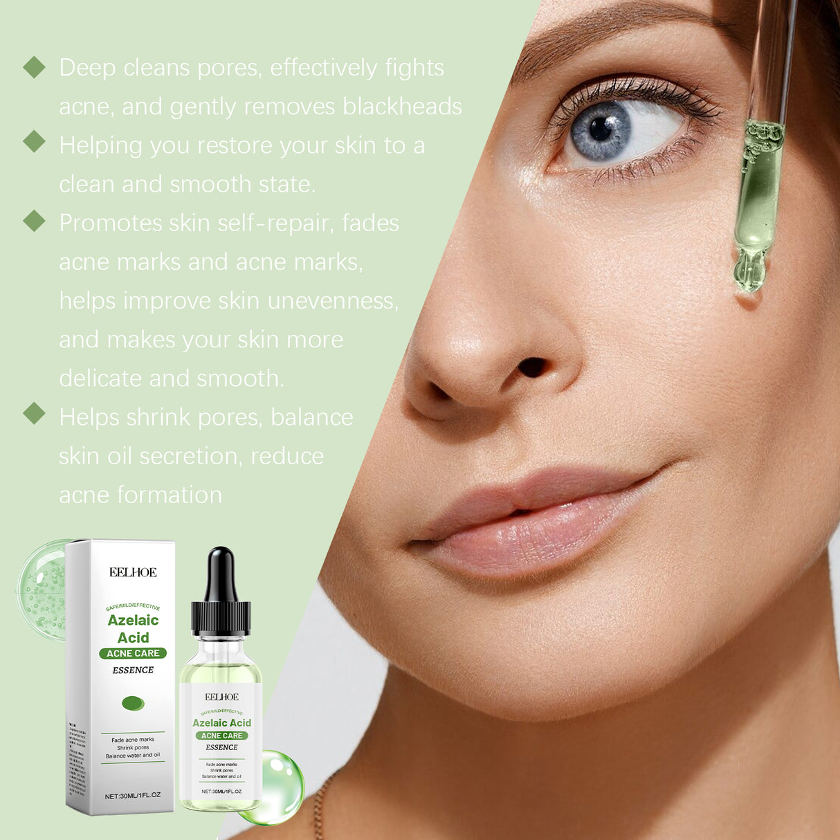 Azelaic Acid Facial Essence Moisturizes And Improves The Skin For Blackheads And Acne