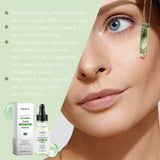 Azelaic Acid Facial Essence Moisturizes And Improves The Skin For Blackheads And Acne