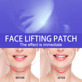 Face Lifting Patch V-Shaped Face Lifting Patch Skin Firming And Thin Chin Muscle Lifting And Swelling Elimination Shaping Patch - V.I.P Digital Presence