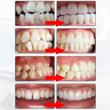 Adult Dental Tooth Orthodontics Dental Braces Teeth Whitening Dental Orthotics Tooth Alignment Tool Orthodontic Retainers - V.I.P Digital Presence