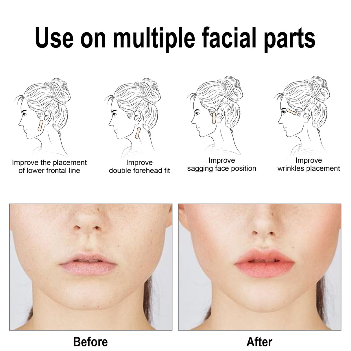 Facial Lifting Patch, Lift Face Double Chin V Face Melon Seed Face Invisible Lifting Patch - V.I.P Digital Presence